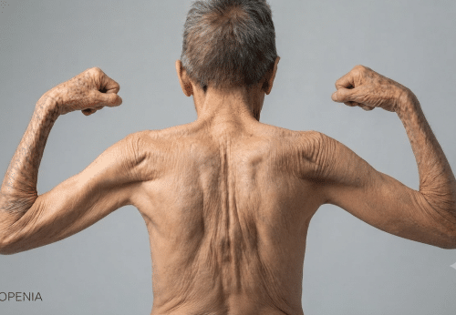 Sarcopenia: Entenda as Implicações para a Saúde da Coluna